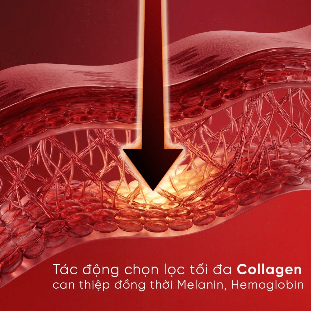 Collagen Banking là gì? Xu hướng & Phương pháp dự trữ Collagen cho làn da 9 675 nm là bước sóng đầu tiên và duy nhất tương tác trực tiếp Collagen
