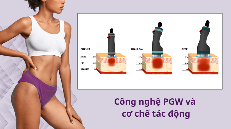 Onda PRO là gì? Giải mã công nghệ Onda Coolwaves giảm mỡ không xâm lấn từ DEKA 5 Onda-PRO-la-gi-4