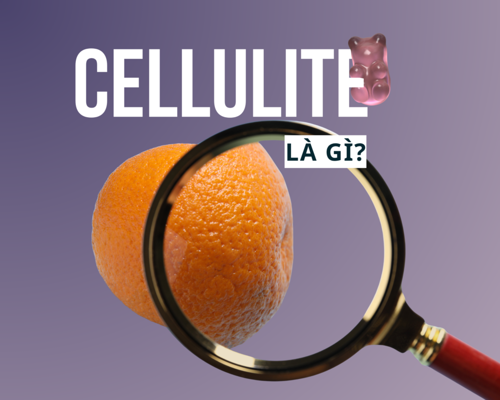 cellulite là gì - nguyên nhân cellulite