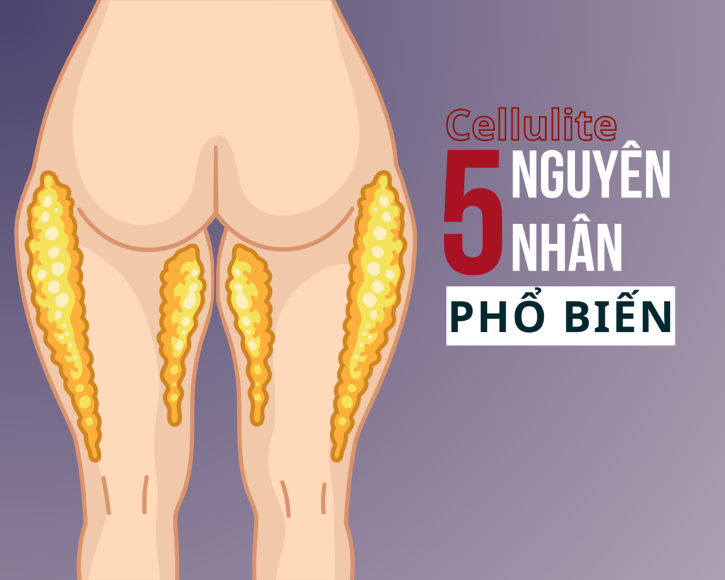 Các nguyên nhân phổ biến gây nên tình trạng da sần vỏ cam