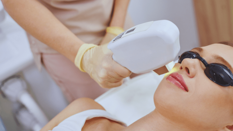 Phương pháp dự trữ collagen: Vì sao laser được chuyên gia đánh giá cao? 5 phuong-phap-du-tru-collagen-10