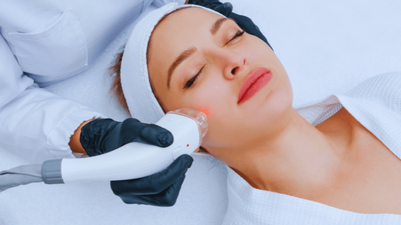 Phương pháp dự trữ collagen: Vì sao laser được chuyên gia đánh giá cao? 4 phuong-phap-du-tru-collagen-9