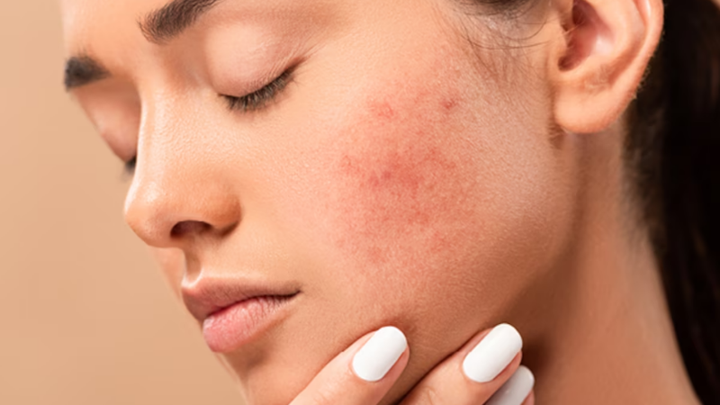 Phương pháp tăng sinh collagen cá nhân hóa theo độ tuổi (25+, 30+, 40+) 3 phuong-phap-tang-sinh-collagen-2