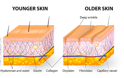 Sự suy giảm và biến tính Collagen, Elastin ở tầng trung bì 