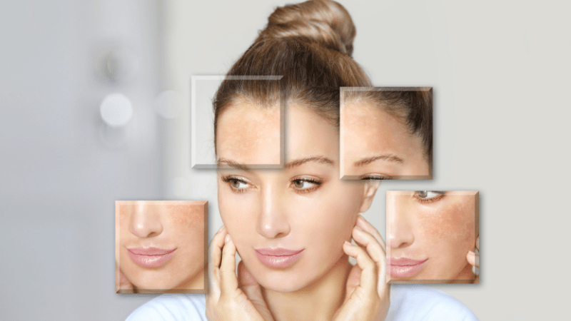 Tại sao xu hướng collagen banking được phái đẹp ưu tiên? 2 xu-huong-collagen-banking-5