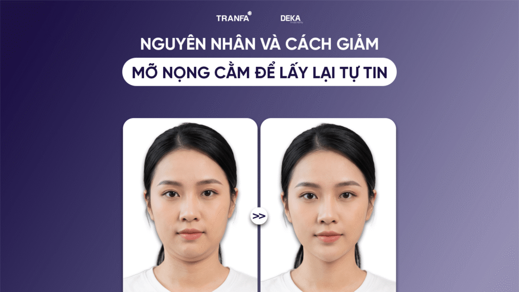 Nguyên nhân và cách giảm mỡ nọng cằm để lấy lại tự tin 1 nguyen-nhan-cach-giam-mo-nong-cam