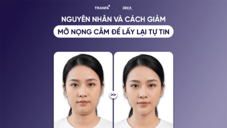 nguyen-nhan-cach-giam-mo-nong-cam