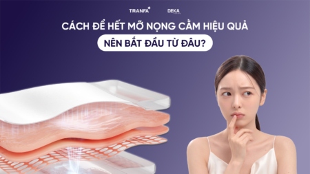cach-de-het-mo-nong-cam