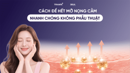cach-de-het-mo-nong-cam