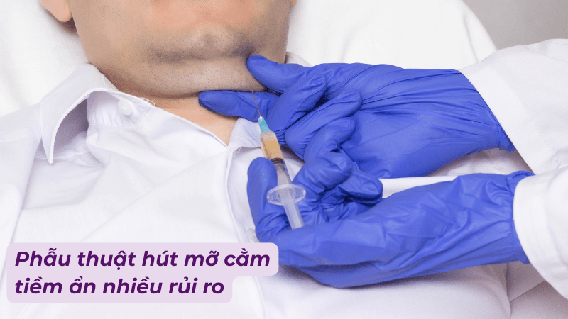 cach-de-het-mo-nong-cam-2